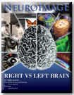 Neuro Image September 2013